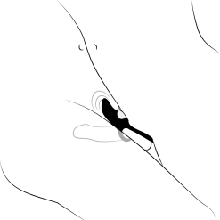 Sinful Melt Koppels Vibrerende Cockring Met Afstandsbediening -Sexy lingerie Verkoop 23452 sinful melt rechargeable remote vibrating couple s cock ring 10 illustration q100